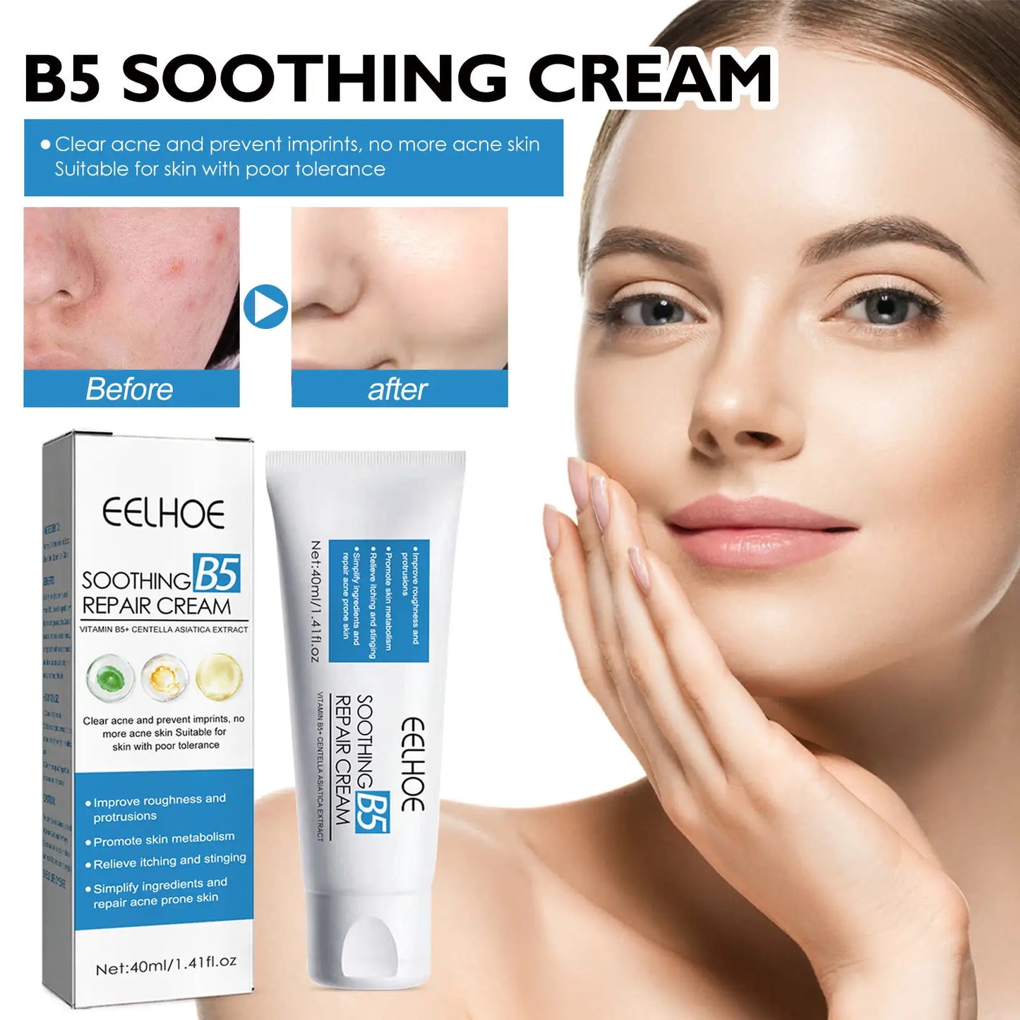 Sets of 10 B5 Soothing Repair Cream, Vitamin B5 and Centella Asiatica, Acne Treatment, 40ml