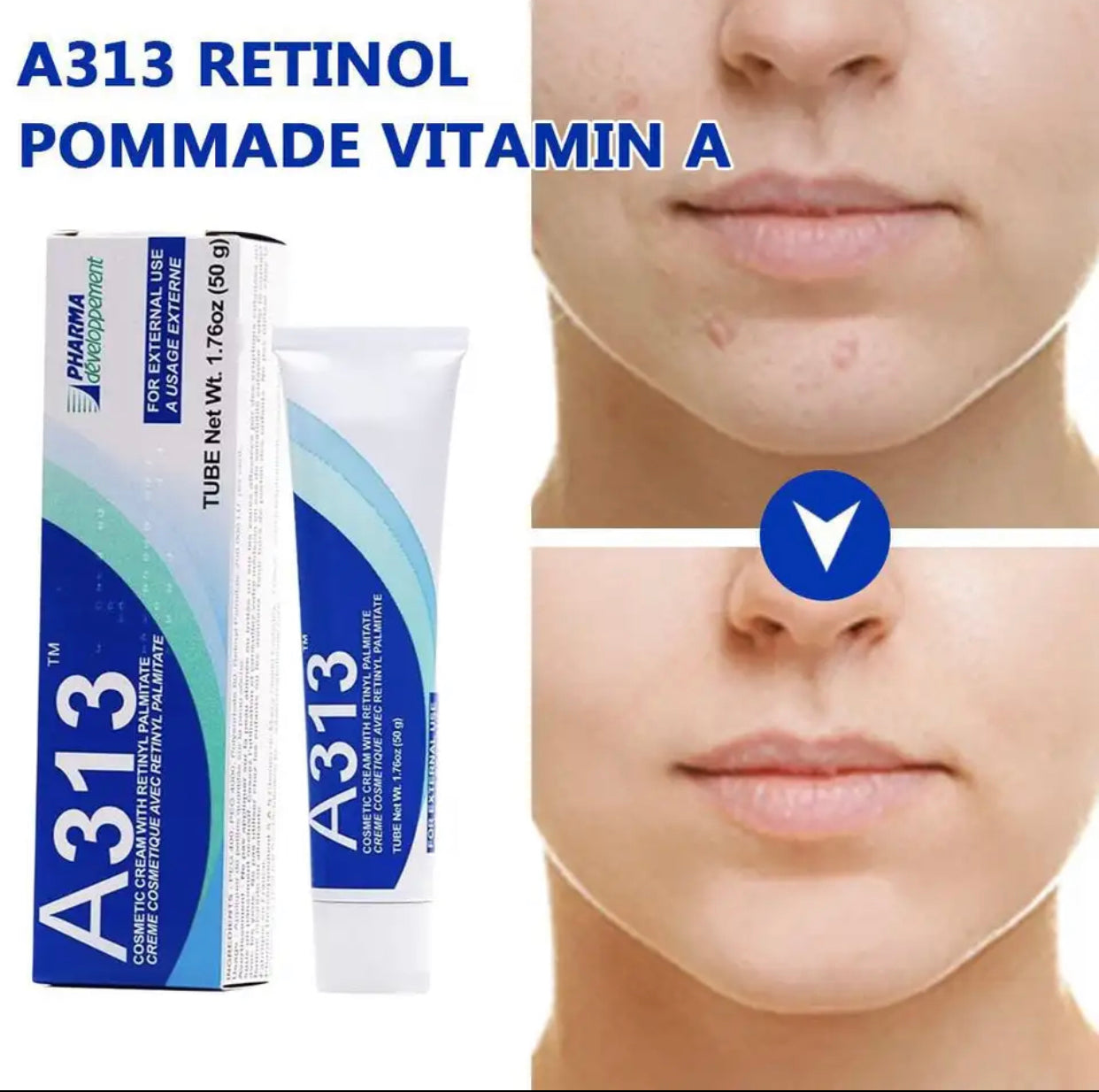 Sets of 2 A313 Retinol Vitamin A Facial Night Cream, 50g, Anti-Aging Moisturizer