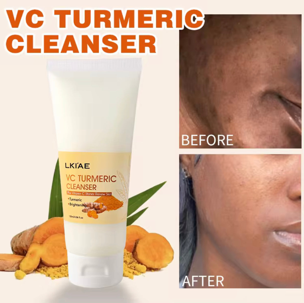 Sets of 3 LKIAE Turmeric Face Cleanser with Vitamin C, Brightening and Renewing Formula, 120 ml, Pack of 3