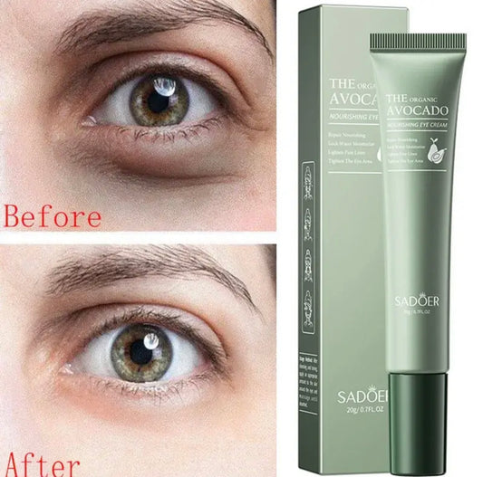 Sets of 10 - Eye Cream for Dark Circles, Anti-Wrinkle & Fine Line Treatment – Moisturizing, Puffiness & Eye Bags Relief